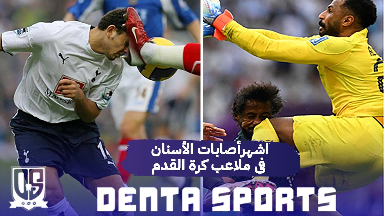 أشهر إصابات الفم والأسنان في ملاعب كرة القدم